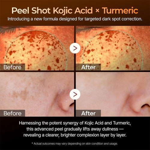 سرم پیل شات کوجیک اسید و زردچوبه دکتر ملاکسین لایه بردار ملایم و روشن کننده قوی پوست Dr.Melaxin Peel Shot Exfoliating Kojic Acid Turmeric Serum