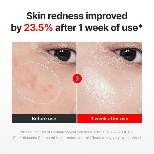 مادکا کرم ضدچروک، تسکین دهنده، ترمیم کننده و جوانساز سنتلین 24 Centellian24 Madeca Cream Time Reverse