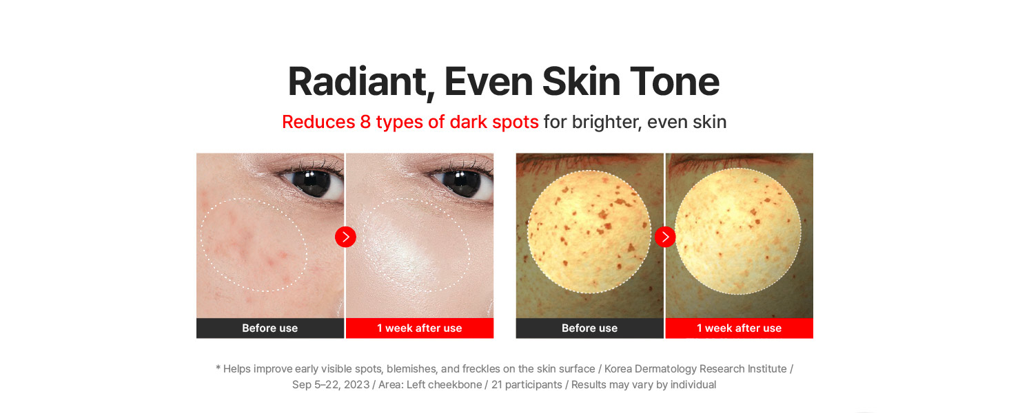مادکا کرم ضدچروک، تسکین دهنده، ترمیم کننده و جوانساز سنتلین 24 Centellian24 Madeca Cream Time Reverse