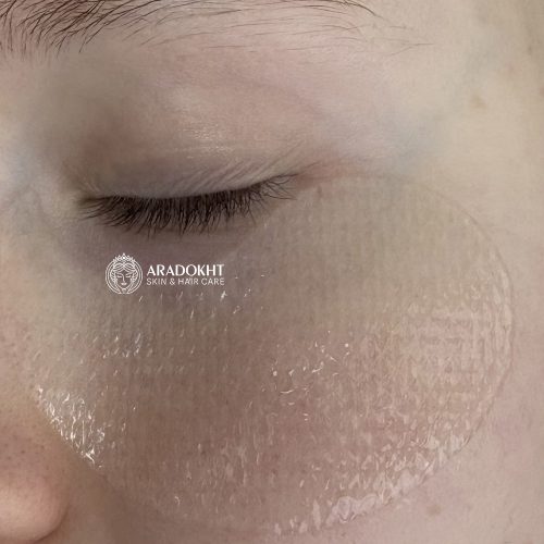 پچ ژلی روشن کننده زیر چشم ویتامین سی نارنگی سبز گودال Goodal Green Tangerine Vita C Eye Gel Patch