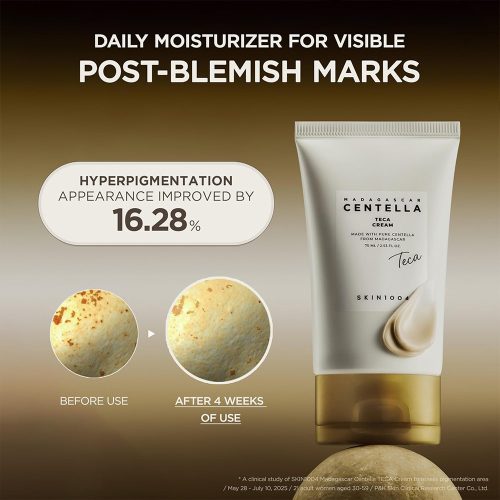 کرم تسکین دهنده و ترمیم کننده سنتلا تیکا اسکین 1004 SKIN1004 Madagascar Centella Teca Cream