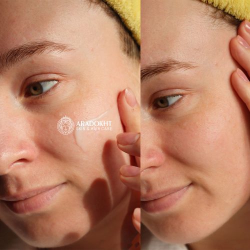 کرم مرطوب کننده افکلار پوست چرب لاروش پوزای La Roche-Posay Effaclar MAT Mattifying Face Moisturizer