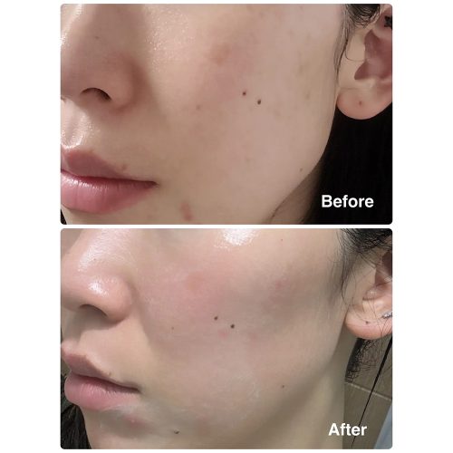 کرم مرطوب کننده گلوتاتیون ابیب ضد لک، روشن کننده و تقویت سد دفاعی پوست Abib Glutathiosome Cream Vita Tube