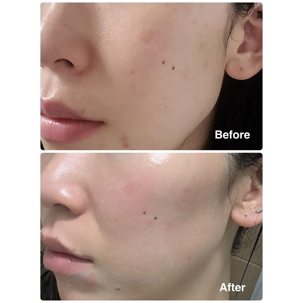 کرم مرطوب کننده گلوتاتیون ابیب ضد لک، روشن کننده و تقویت سد دفاعی پوست Abib Glutathiosome Cream Vita Tube