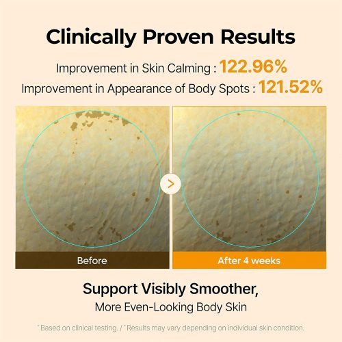 کرم کپسولی روشن کننده بدن کوجیک اسید و زردچوبه دکتر ملاکسین Dr.Melaxin Kojic Acid Turmeric Capsule Body Cream