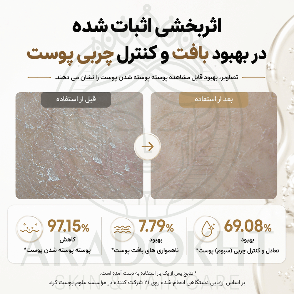 تونر گلیکولیک اسید 10 درصد آرنسیا لایه بردار ضد جوش، کنترل منافذ و روشن کننده پوست Arencia Erasor Shot Glycolic Acid 10% + BHA Exfoliating Toner