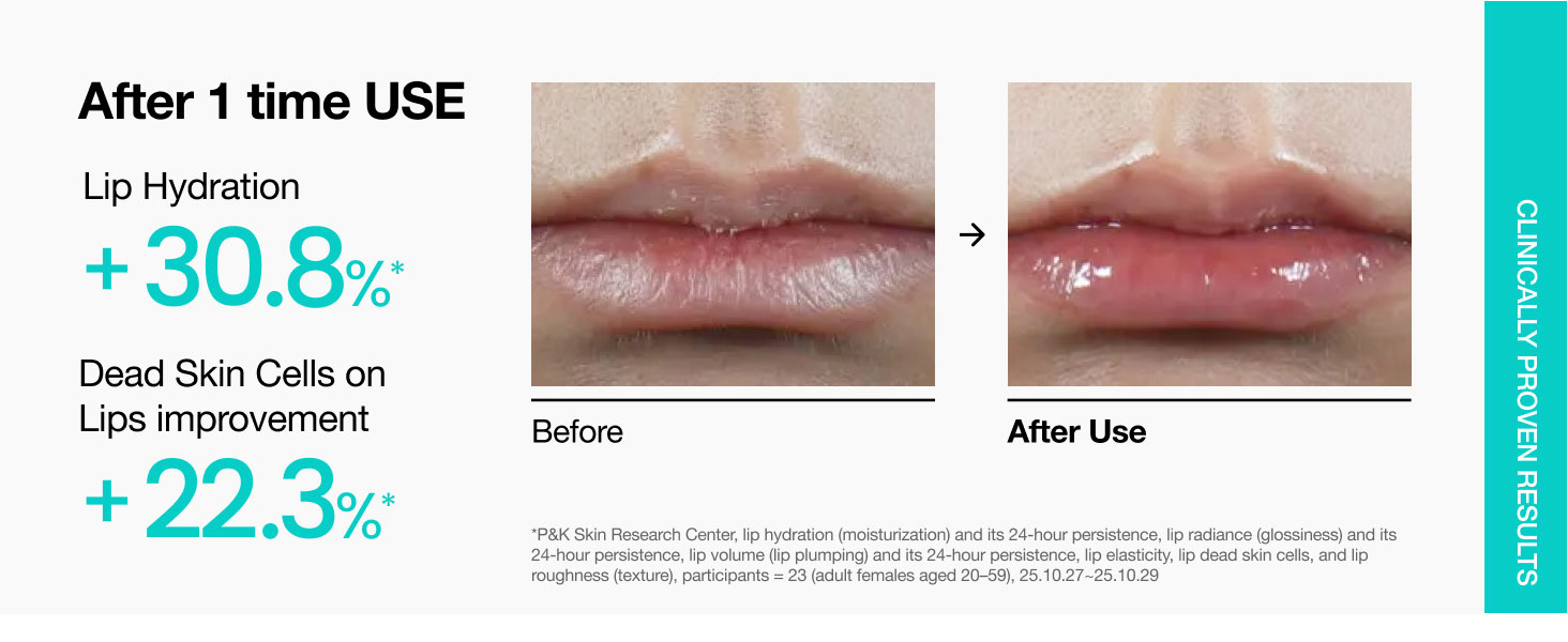 سرم لب PDRN آنوا آبرسان، نرم کننده و ترمیم کننده Anua PDRN Lip Serum