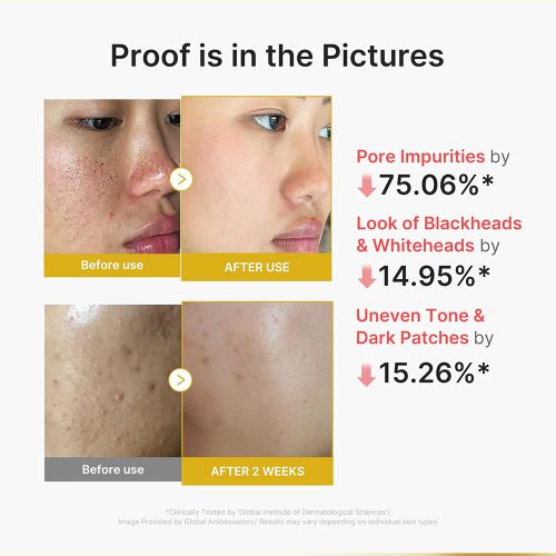 سرم پیل شات کوجیک اسید و زردچوبه مدی کیوب لایه بردار ملایم و روشن کننده قوی پوست medicube Kojic Acid Turmeric Peel Shot