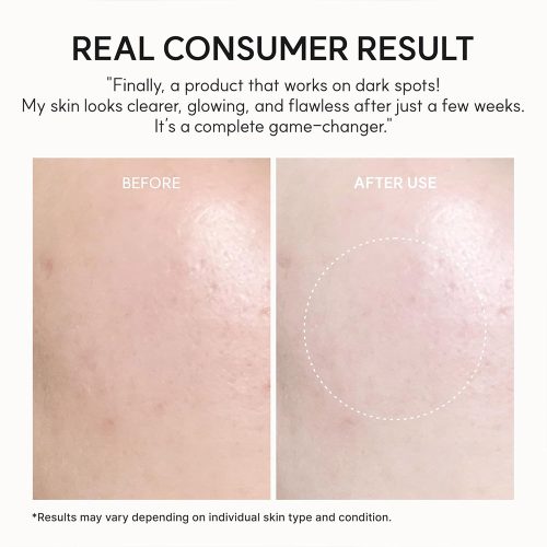 ژل کرم بوستر شات ویتامین سی آرنسیا آبرسان و روشن کننده قوی تیرگی ها Arencia Vitamin C Glow Booster Gel Cream