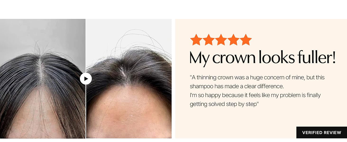 شامپو ضد ریزش و حجم دهنده موی لیلیوئه lilyeve Grow Turn Exosome 3D Volume Brush Shampoo
