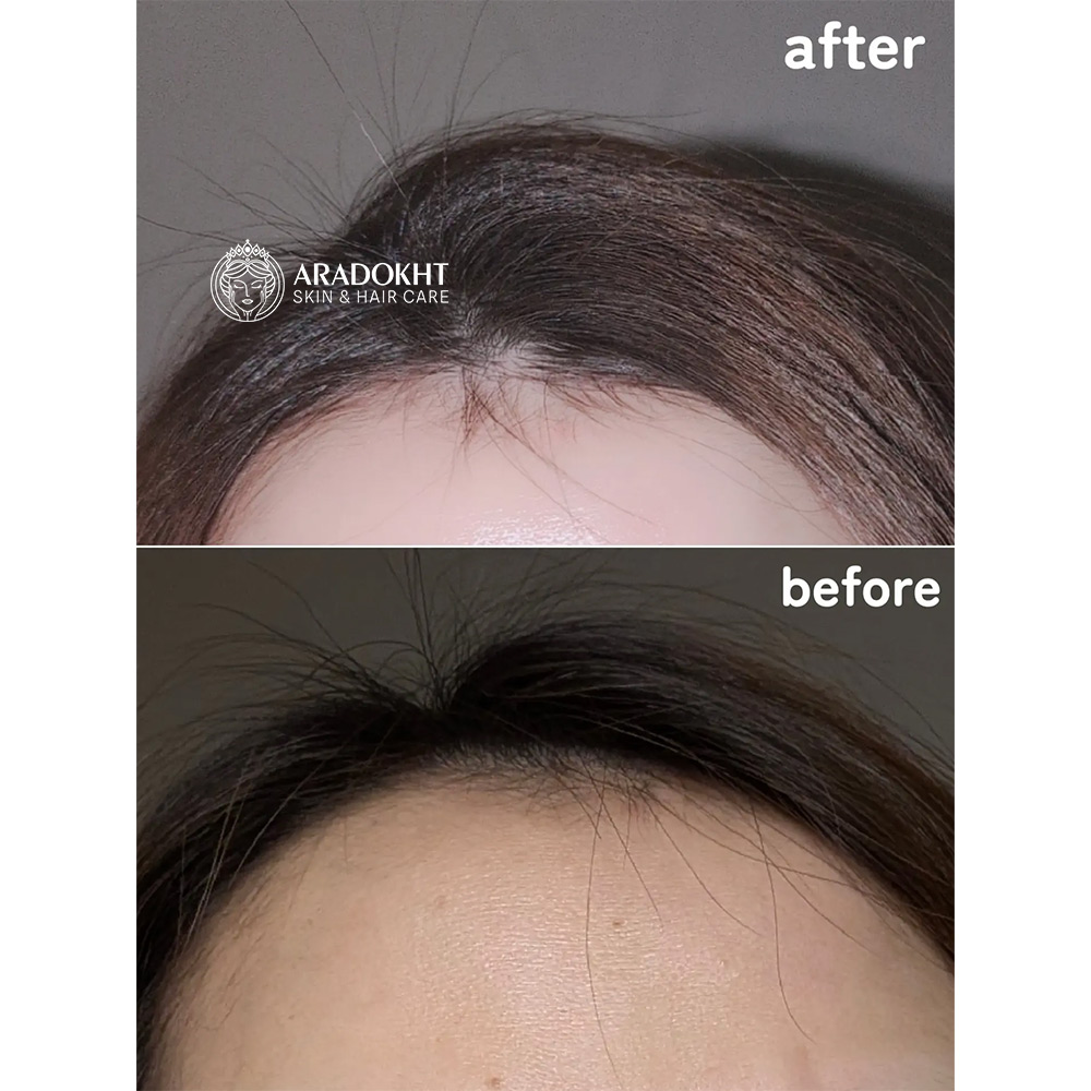 شامپو ضد ریزش و حجم دهنده موی لیلیوئه lilyeve Grow Turn Exosome 3D Volume Brush Shampoo