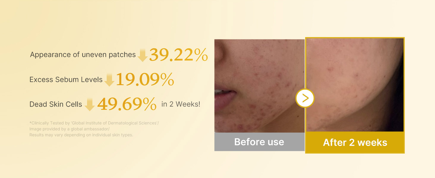 پد تونر روشن کننده کوجیک اسید و زردچوبه مدی کیوب MEDICUBE Kojic Acid Turmeric Pad