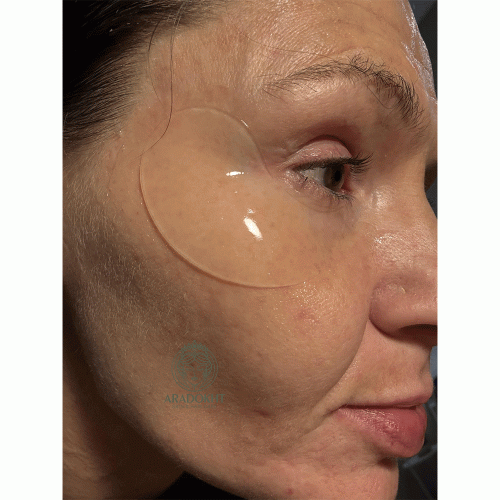 پچ زیر چشم رتینال آرنسیا ضد چروک، روشن کننده و آبرسان Arencia Retinal Boosting Eye Mask