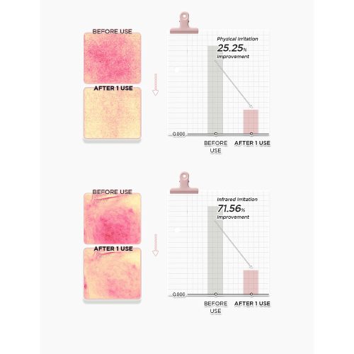 کرم ترمیم کننده PDRN 1.5% سنتلا اسکین 1004 تسکین دهنده و تقویت سد دفاعی پوست SKIN1004 Madagascar Centella PDRN 1.5 Cream
