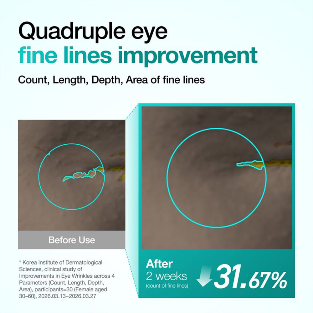 کرم دور چشم PDRN و کافئین آنوا ضد پف و تیرگی، ضد چروک و جوانساز Anua PDRN Caffeine Rejuvenating Eye Cream