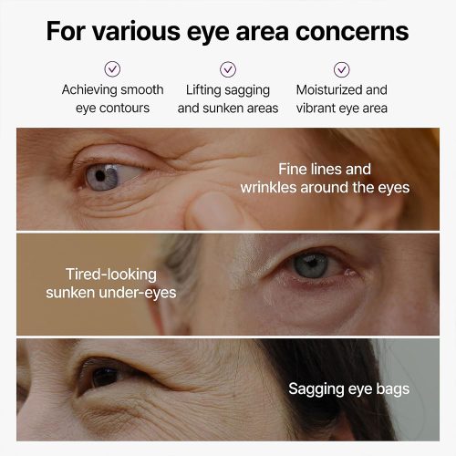 کرم دور چشم ضد چروک و سفت کننده کلسیم دکتر ملاکسین Dr.Melaxin Calcium Bonding Eye Cream