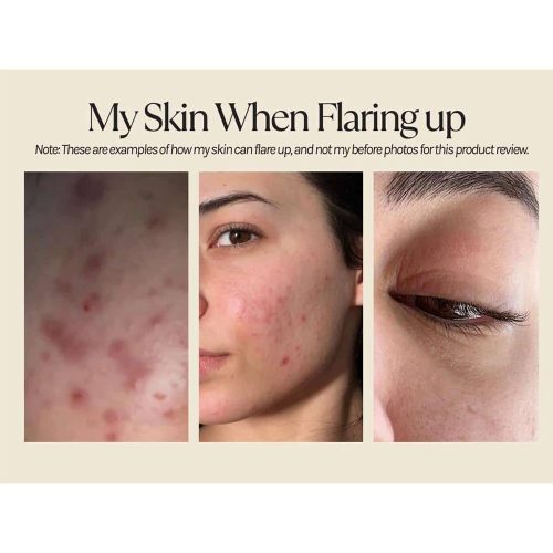 کرم رتینوئید A313 فارما دولوپمنت ضد چروک قوی، ضد لک و جوانساز پوست Pharma Développement A313 Vitamin A Retinol Cream