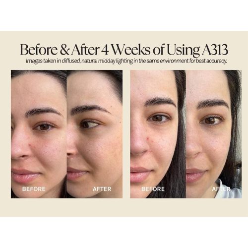 کرم رتینوئید A313 فارما دولوپمنت ضد چروک قوی، ضد لک و جوانساز پوست Pharma Développement A313 Vitamin A Retinol Cream