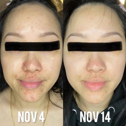 کرم رتینوئید A313 فارما دولوپمنت ضد چروک قوی، ضد لک و جوانساز پوست Pharma Développement A313 Vitamin A Retinol Cream