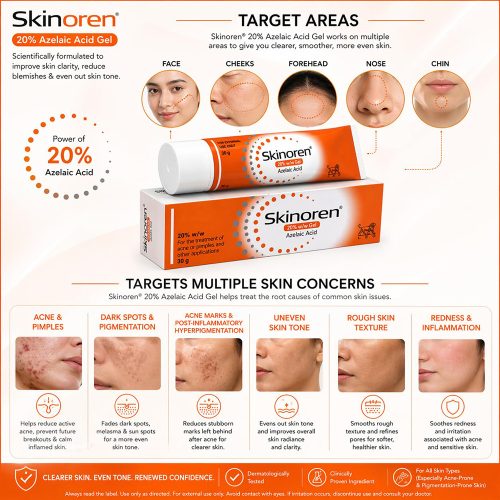 کرم ضد جوش و آکنه آزلائیک اسید 20 درصد اسکینورن لئو فارما Skinoren Cream Azelaic Acid 20% Anti-Acne Treatment