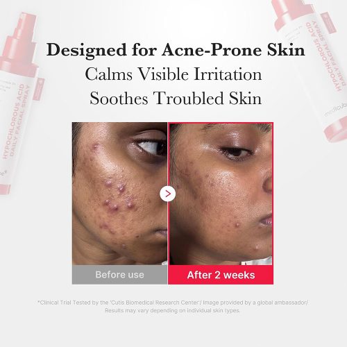 اسپری آبرسان، ضد جوش و تسکین دهنده هیپوکلروس اسید مدی کیوب medicube Hypochlorous Acid Daily Facial Spray