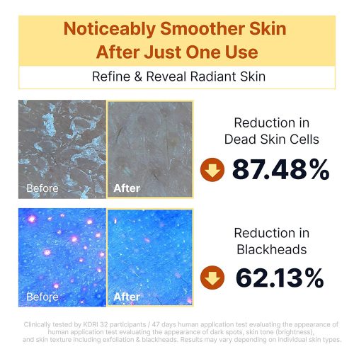 سرم روشن کننده پیل شات کوجیک اسید و نیاسینامید سانگ بون SUNGBOON EDITOR Kojic Acid Niacinamide Brightening Rice Peel Shot