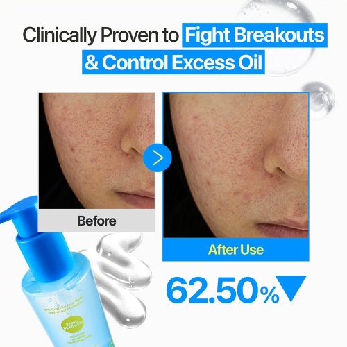 ژل میسلار بدون چربی زیرو بلمیش نامبوزین ضد جوش و پاک کننده عمقی پوست numbuzin Zero Blemish Oil-Free Micellar Cleansing Jelly