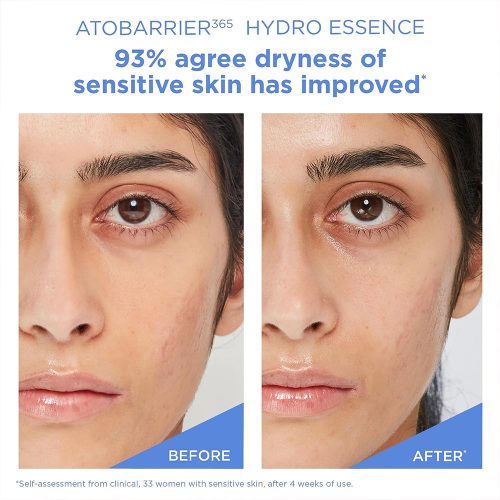 اسنس آبرسان و تقویت کننده سد دفاعی اتو بریر 365 استرا AESTURA ATOBARRIER365 Hydro Essence