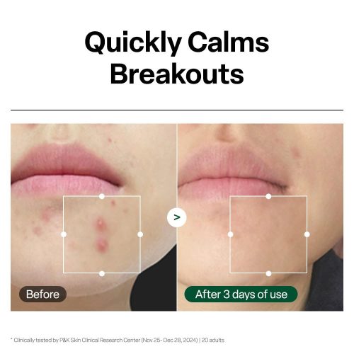 سرم تسکین دهنده التهاب و قرمزی و آبرسان هیال سیکا رد بلمیش دکتر جی Dr.G R.E.D Blemish Clear Hyal Cica Soothing Serum