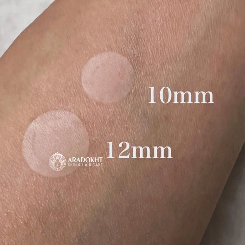 پچ ضد جوش 30 عددی فوق نازک دکتر جی DR.G A'CLEAR ULTRA THIN SPOT PATCH