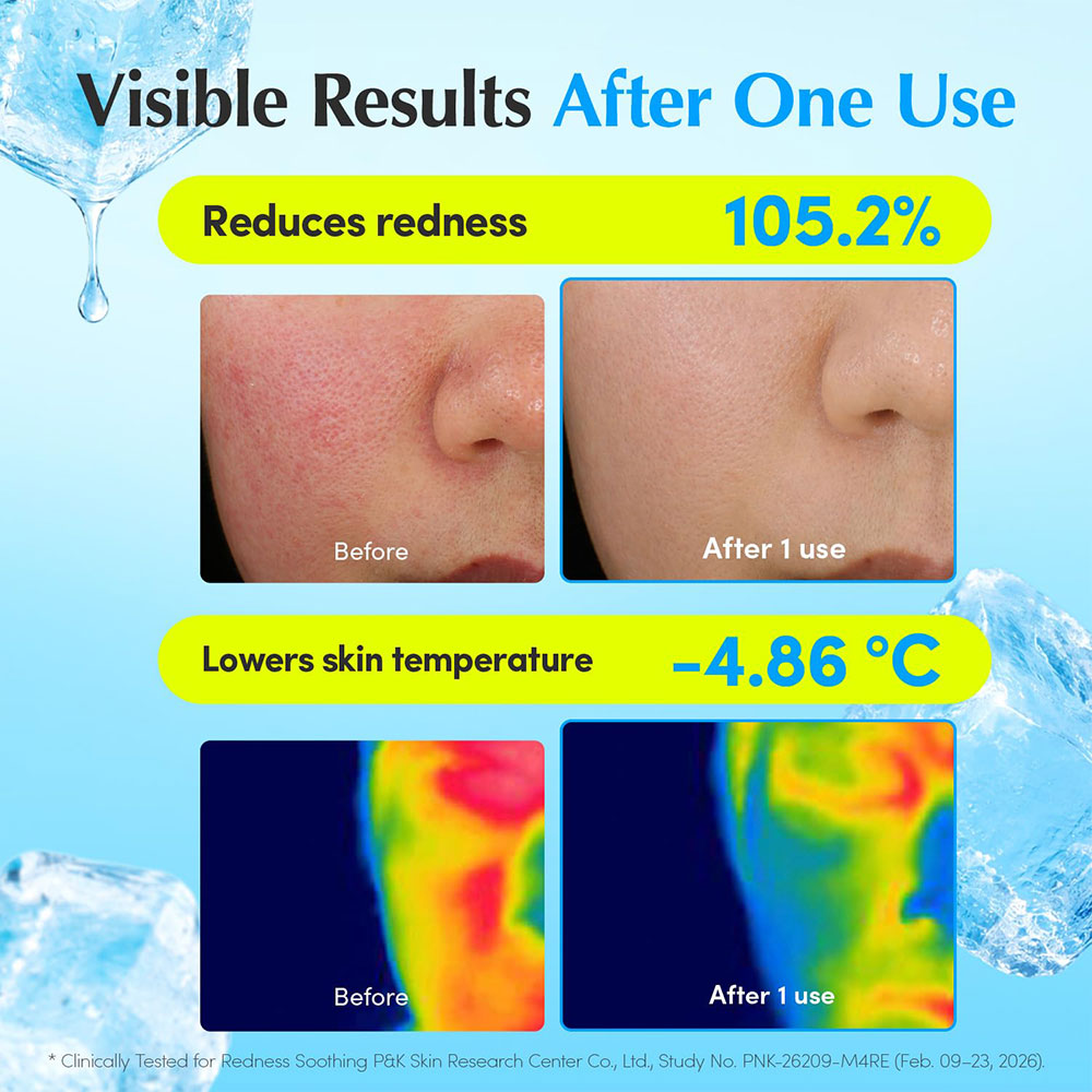 کرم آبرسان، خنک کننده و تسکین دهنده الهتاب و قرمزی هیالتوئین اکوال بری EQQUALBERRY Hyaltoin Flooding Cream