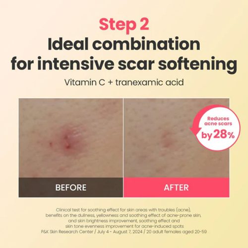 کرم ترمیم کننده، تسکین دهنده و ضد لک رد بلمیش دکتر جی Dr.G R.E.D Blemish Repair Soothing Cream