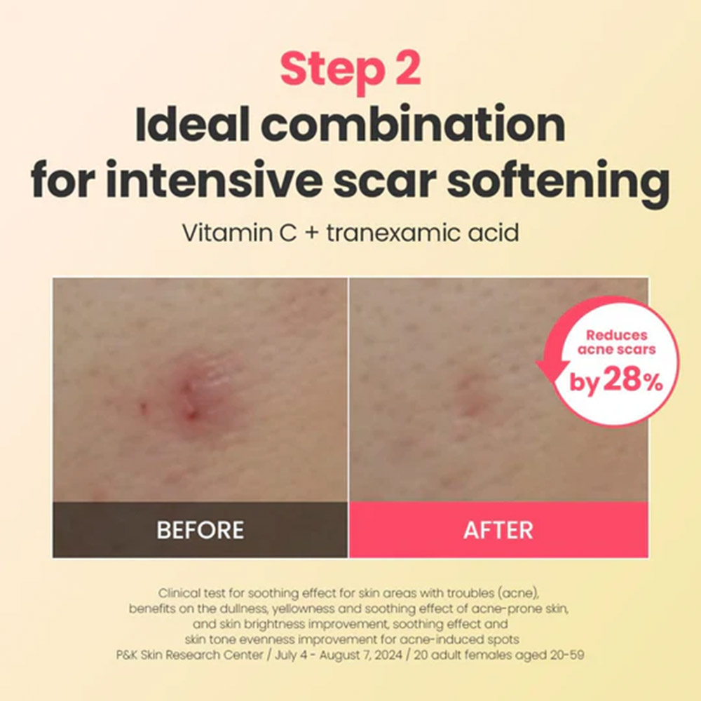 کرم ترمیم کننده، تسکین دهنده و ضد لک رد بلمیش دکتر جی Dr.G R.E.D Blemish Repair Soothing Cream