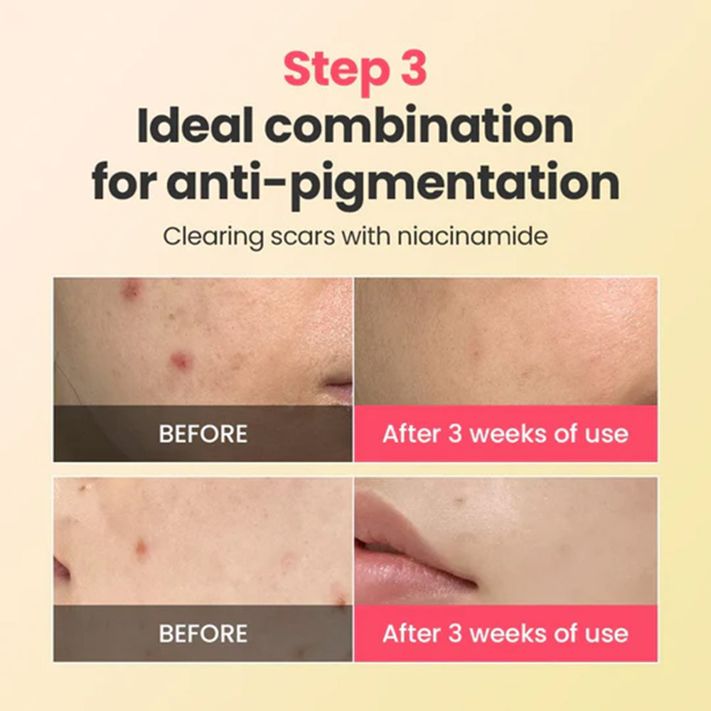 کرم ترمیم کننده، تسکین دهنده و ضد لک رد بلمیش دکتر جی Dr.G R.E.D Blemish Repair Soothing Cream