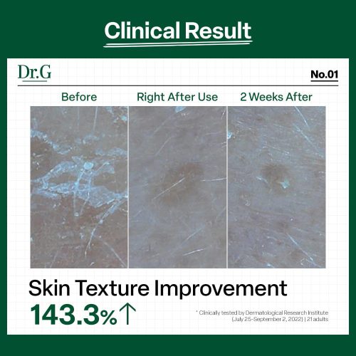 کرم تسکین دهنده و مرطوب کننده پوست خشک و حساس رد بلمیش دکتر جی Dr.G R.E.D Blemish Clear Moisture Cream