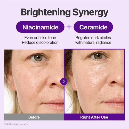 کرم دور چشم ضد چروک و جوانساز رتینال و +NAD شماره 9 نامبوزین numbuzin No.9 NAD+ Retinal Volumetox Eye Cream Tube Type