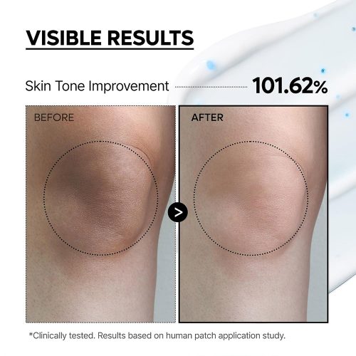 کرم کپسولی ضد لک و روشن کننده تیرگی های بدن ترانگزامیک اسید دکتر ملاکسین Dr.Melaxin TX Capsule Body Cream